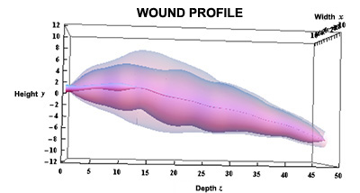 Wound profile reconstruction